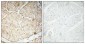 VEGF-A Polyclonal Antibody